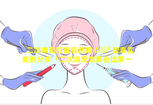 二次填充打造自然胸 🌲 型真实案例分享「二次填充效果会比第一次好吗」